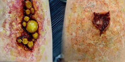 影视特效化妆中的伤效妆制作技巧详解